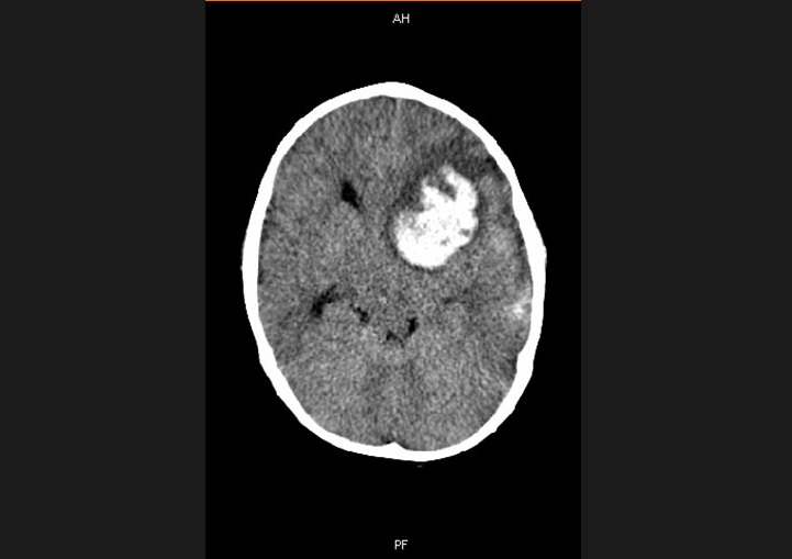 Diagnose The Condition In This 2-Year-Old