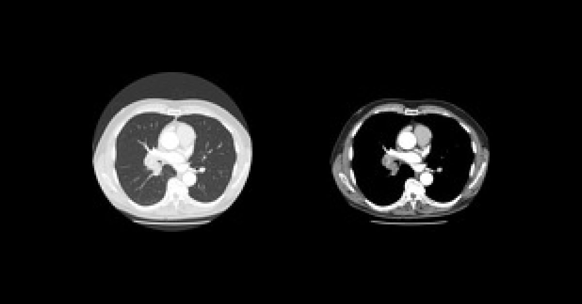 A Male With Shortness Of Breath And Cough