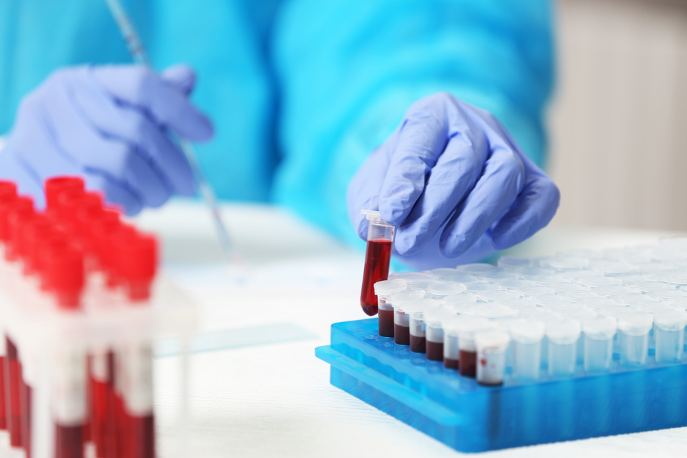Early Detection Of 8 Cancers By A Simple One Blood Test