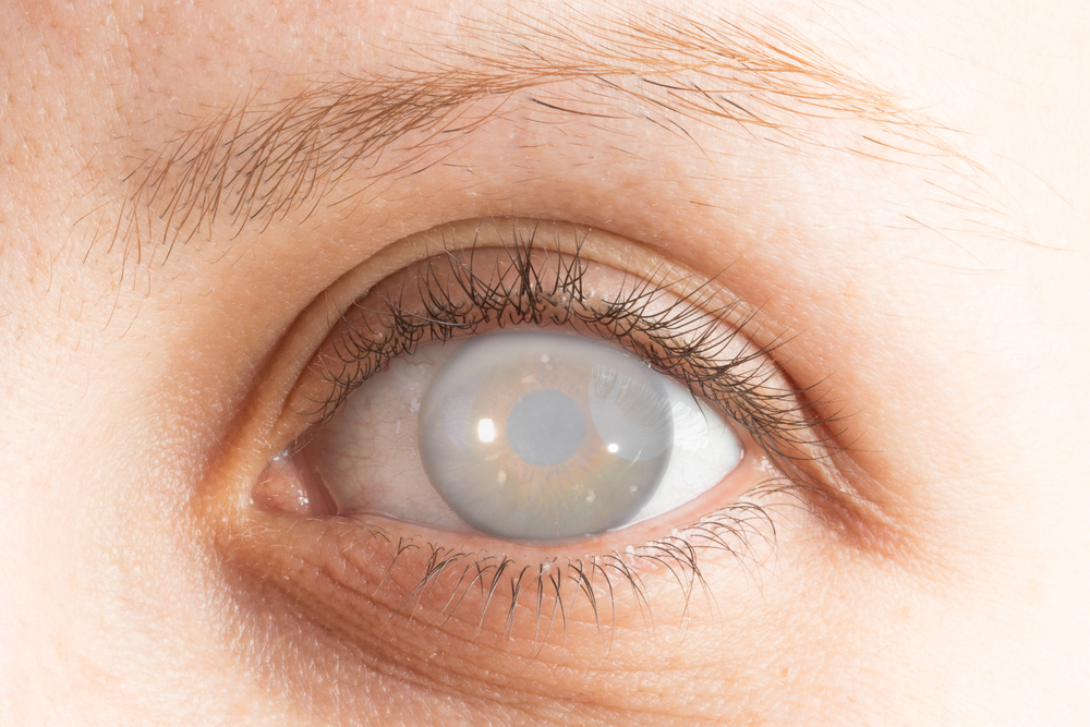 Brief Review On Ocular Findings In Patients With Autoimmune Liver Disease