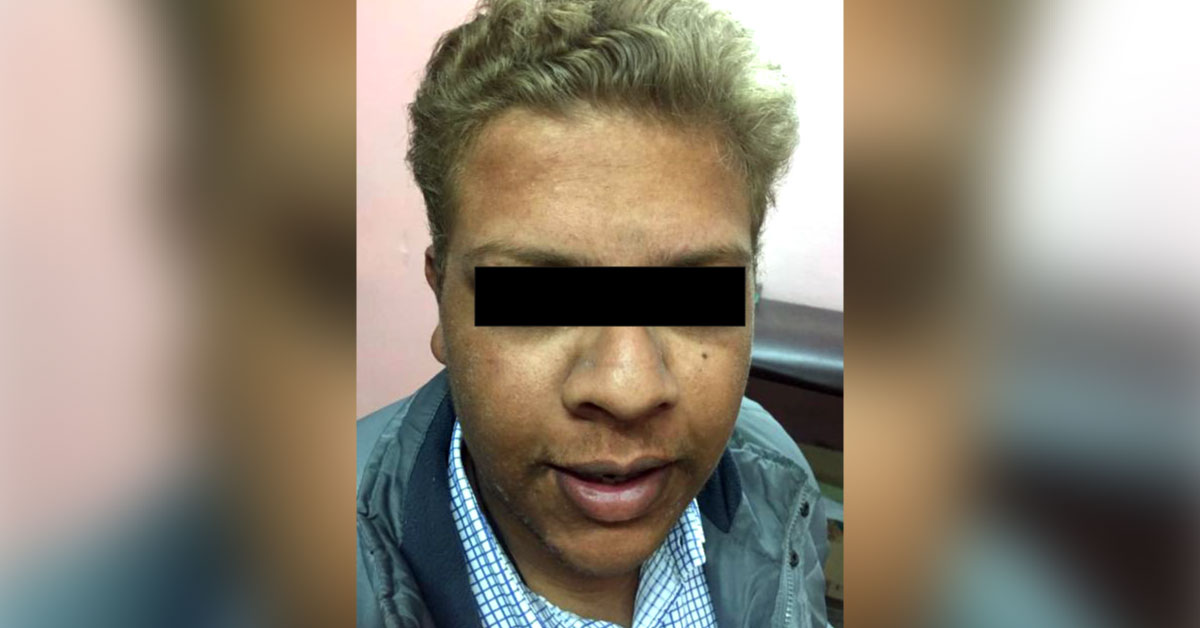 Is This A Genetic Disorder? 