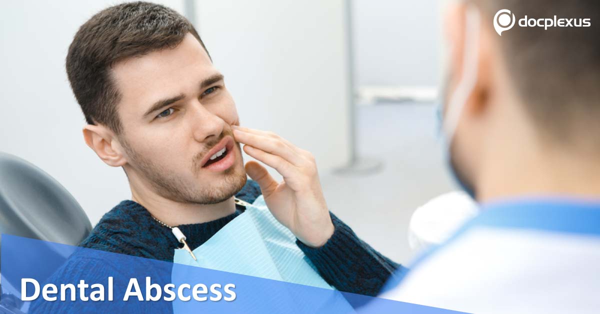 Dental Abscess And Its Management