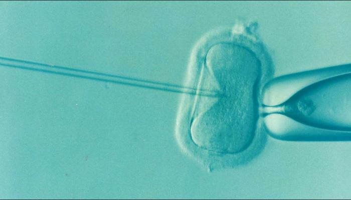 Indian Origin Sperm Sorting Device Improve IVF Success