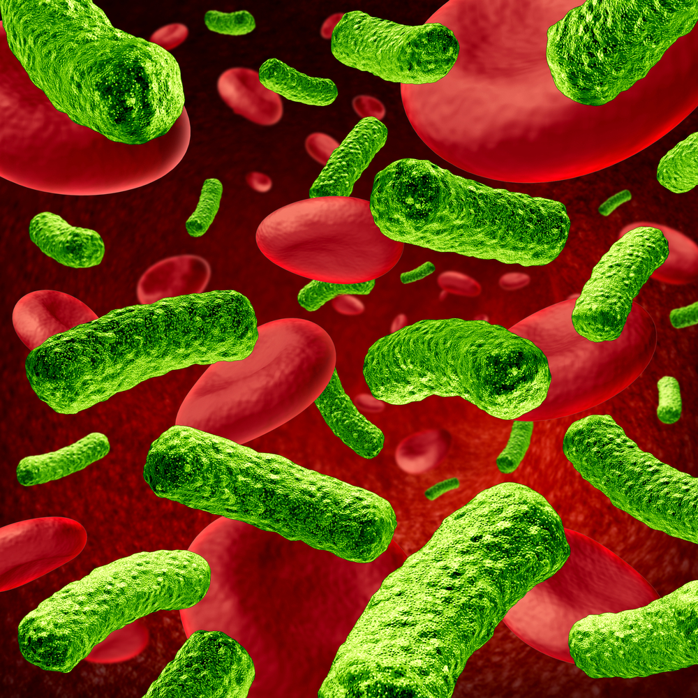 Septic Shock Management
