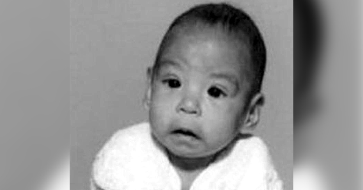 Ophthalmic Manifestations In Children With Mental Retardation