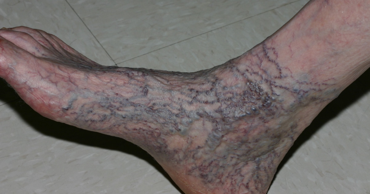 Spot The Diagnosis