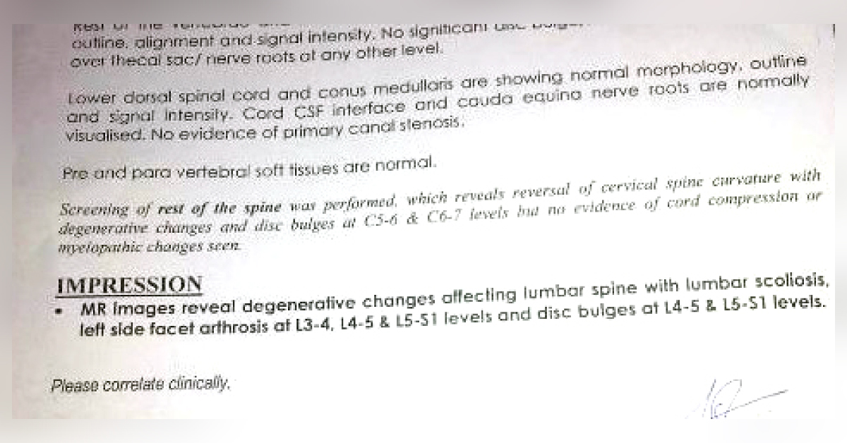 Treatment For Pain In Lumbosacral Region