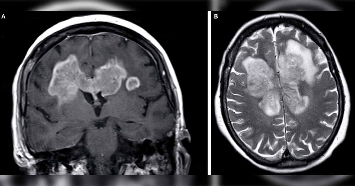 What Can Be the Differential Diagnosis for This Patient?