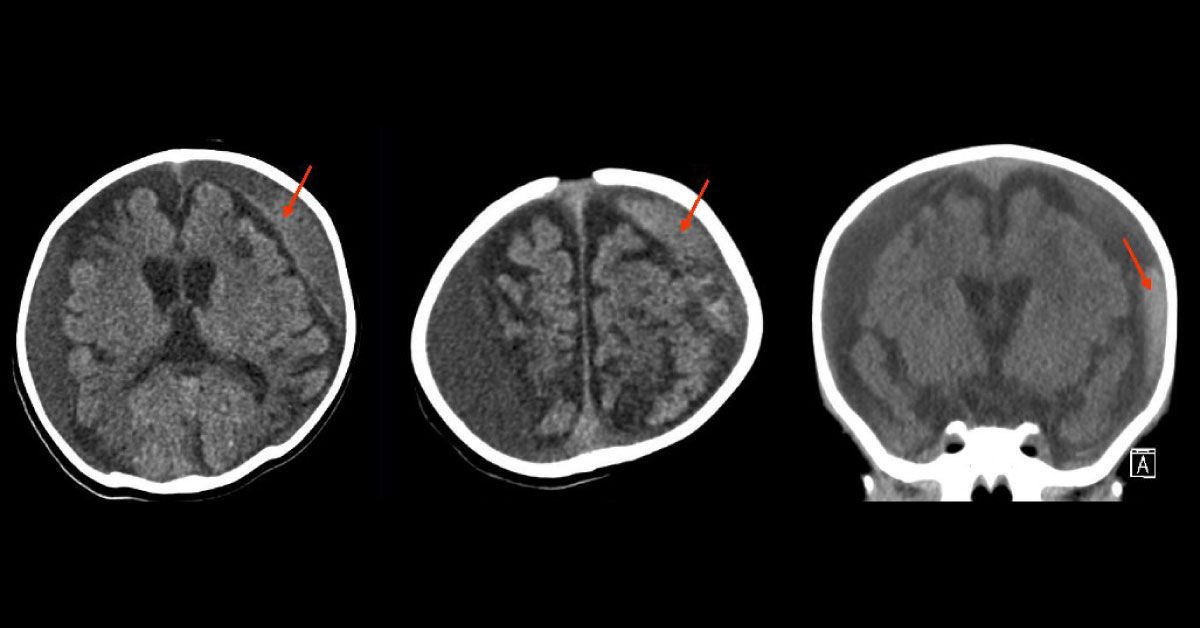 Can You Diagnose the Case of This Child?