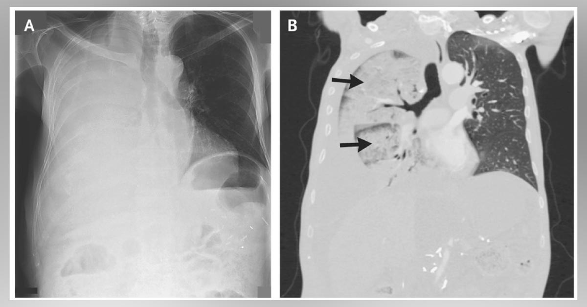 Identify This Condition And Suggest Management