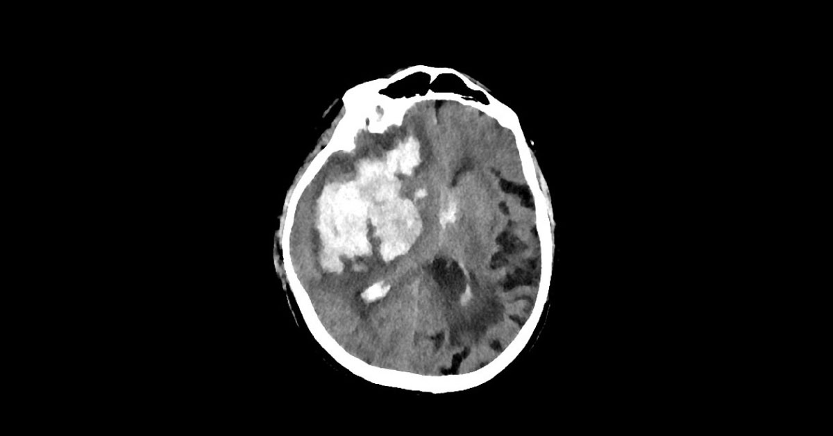 Interpret the Radiologic Findings
