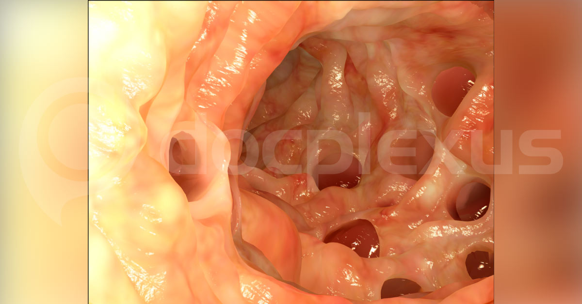 Can You Diagnose This Patient With Abdominal Pain?