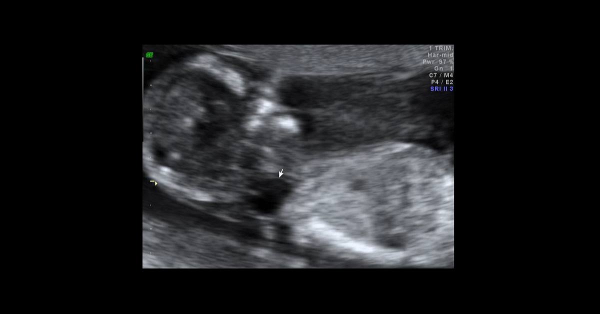 Spot The Diagnosis