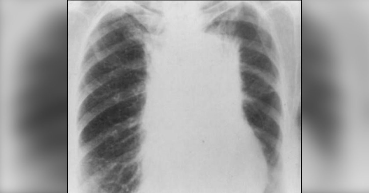 Spot This Underlying Condition