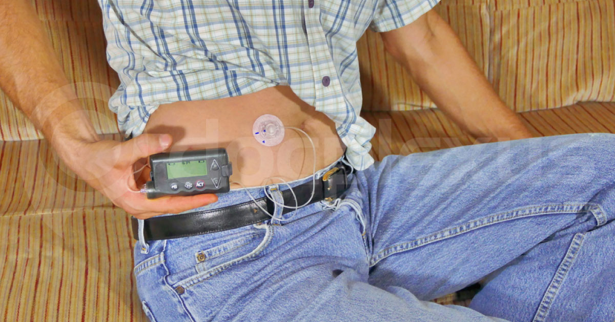 Ketones In Diabetes – Villain Or Misunderstood Hero!
