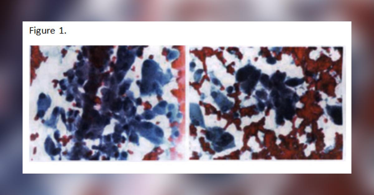 What Does The Cytology Report Reveal?