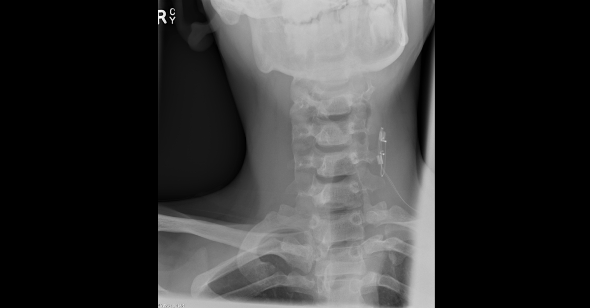 Interpret These Radiologic Findings