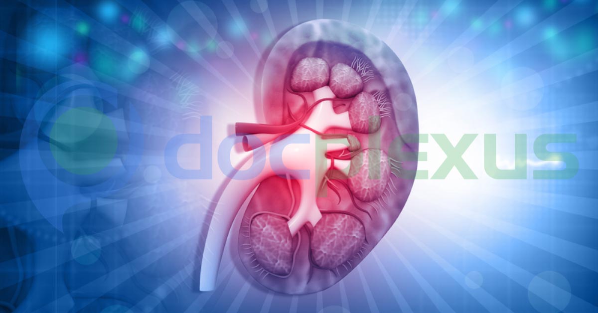 A 45-Year-Old Male With Sarcoma And Renal Failure