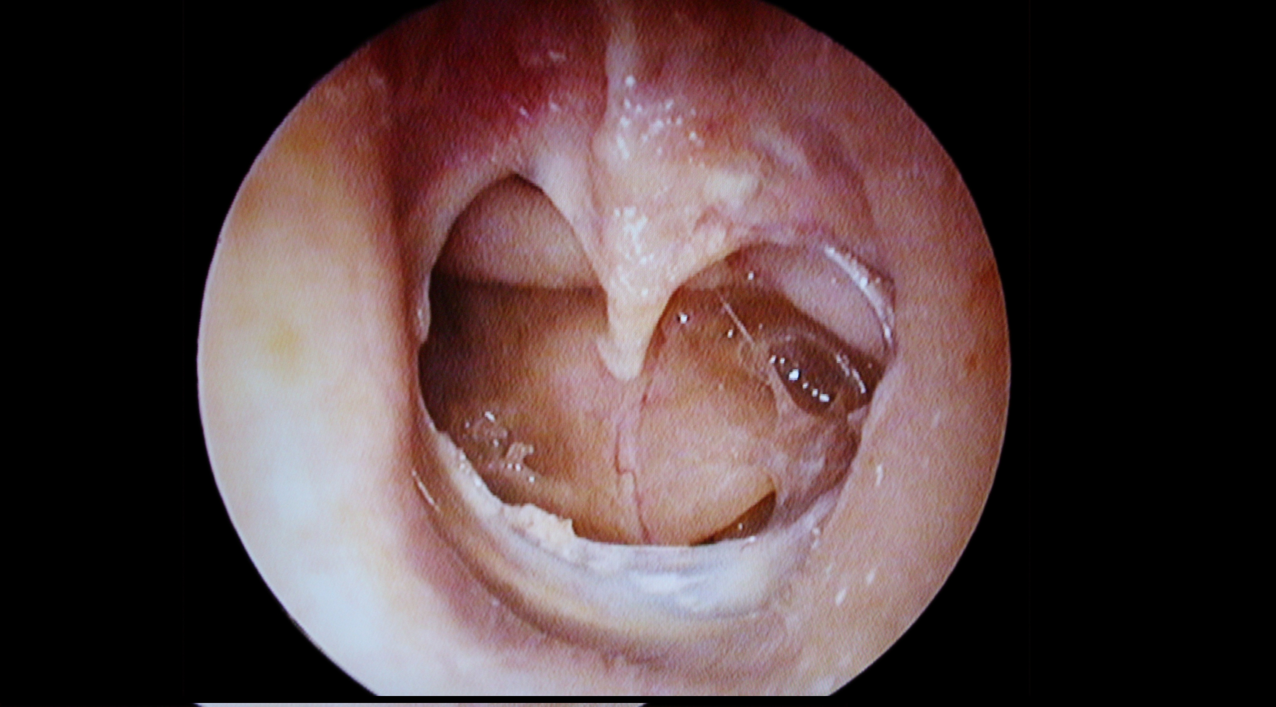 Interpret The Clinical Condition