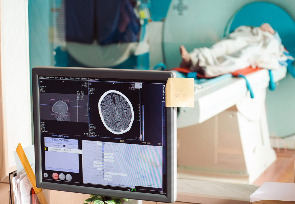Cisplatin Chemoradiotherapy Vs Radiotherapy In FIGO Stage IIIB Squamous Cell Carcinoma Of The Uterine Cervix