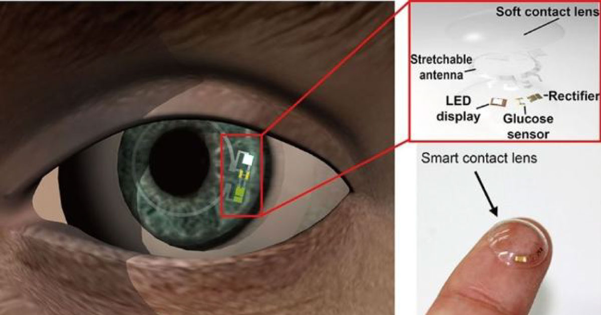 Smart Contact Lens In Eye Will Monitor Blood Glucose In Diabetics By Tear