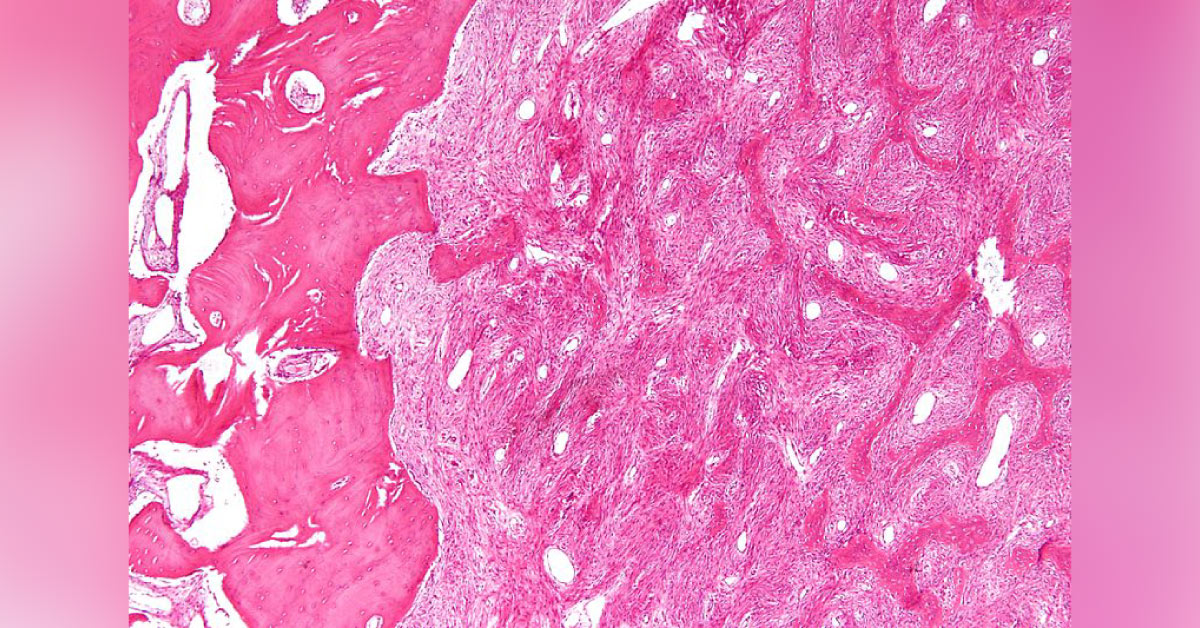 Identify the Underlying Condition