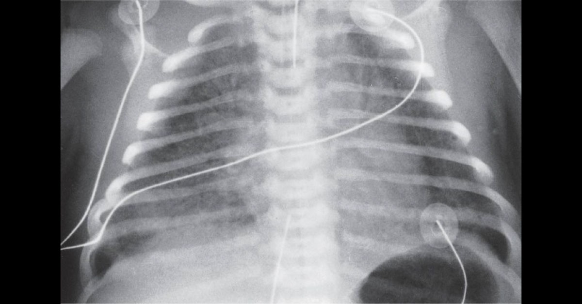 Identify The Underlying Condition