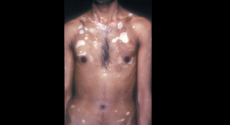Diagnose The Dermatological Condition