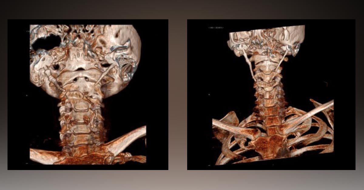What Does This CT Reveal?