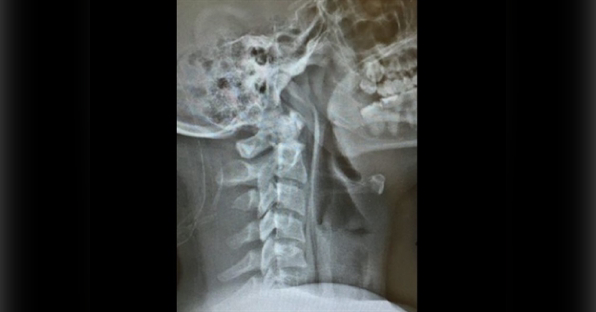Spot The Diagnosis