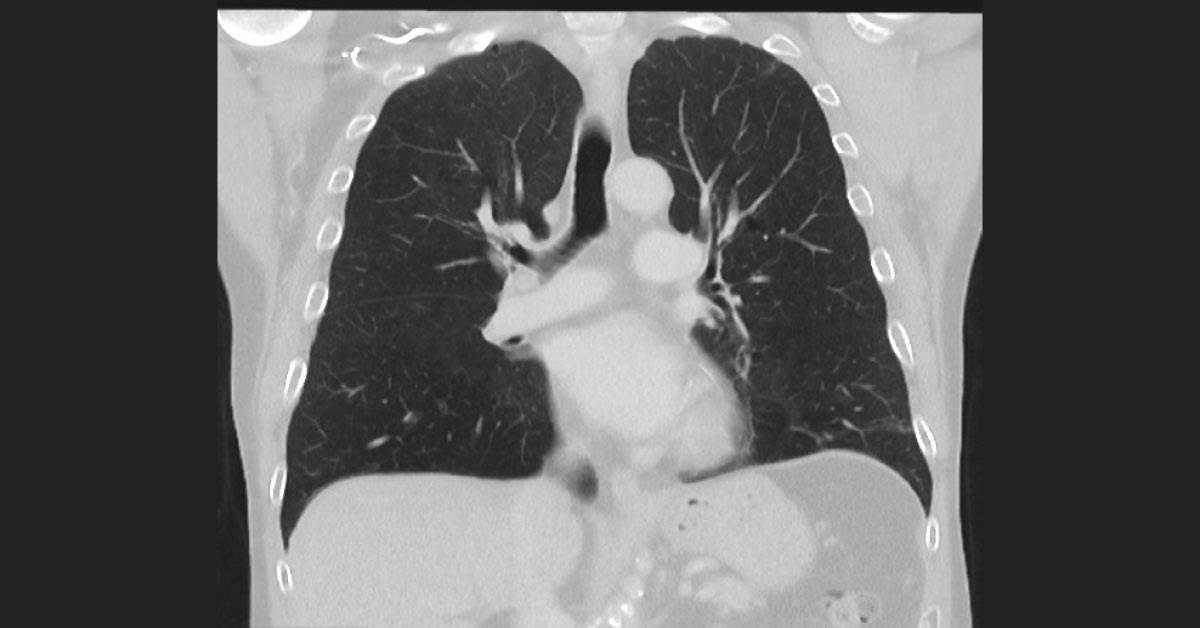 Interpret This Oncologic Condition
