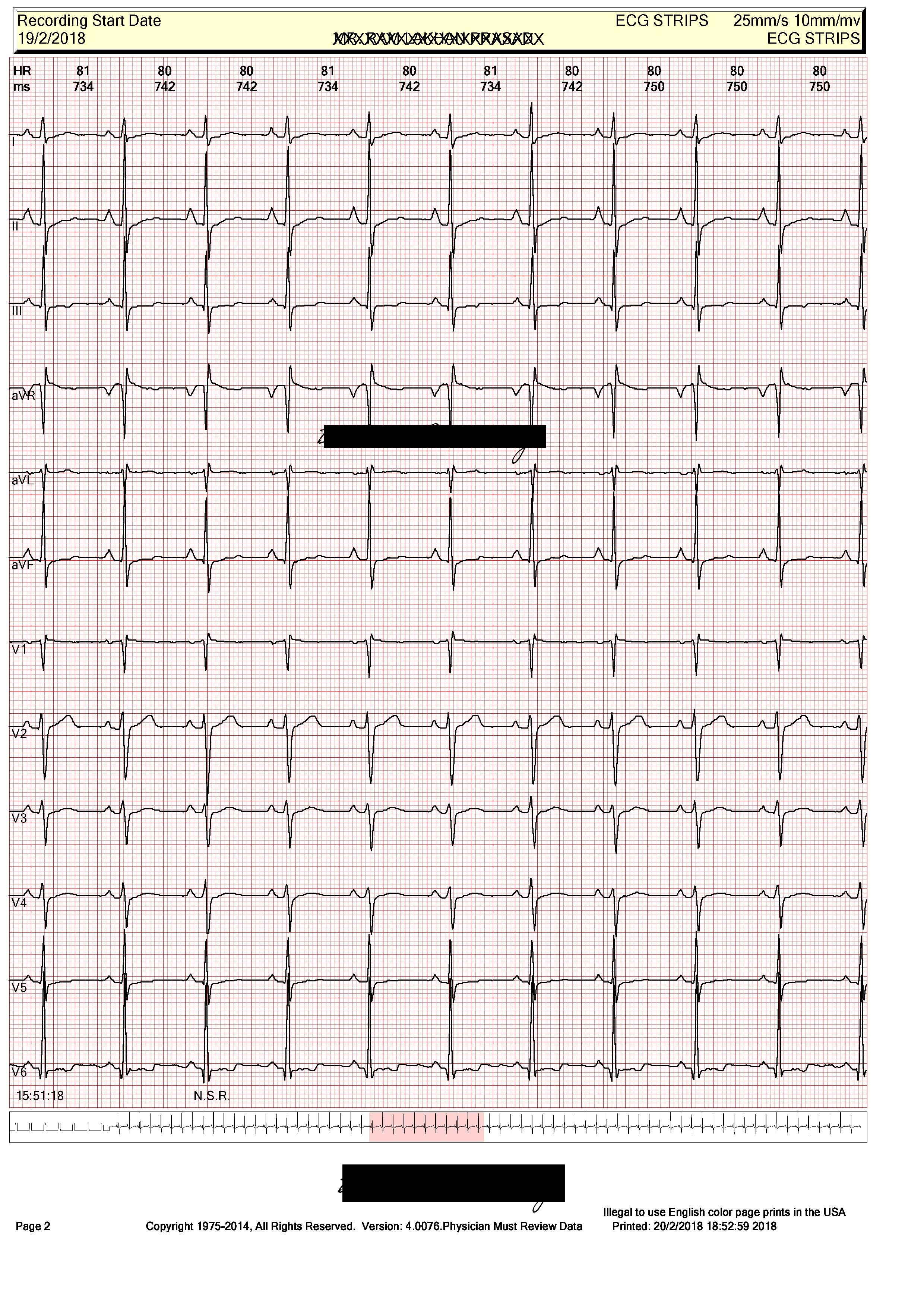 Holter Study For Neurologist Also