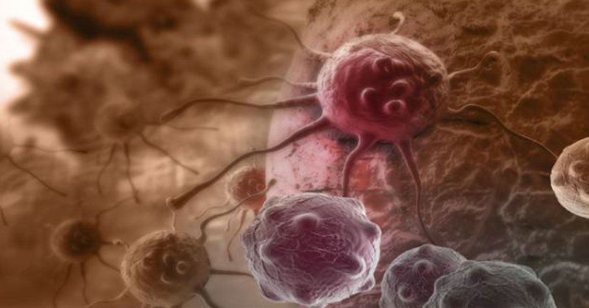 The "Cure" For Cancer, The Myth Or A Reality ?