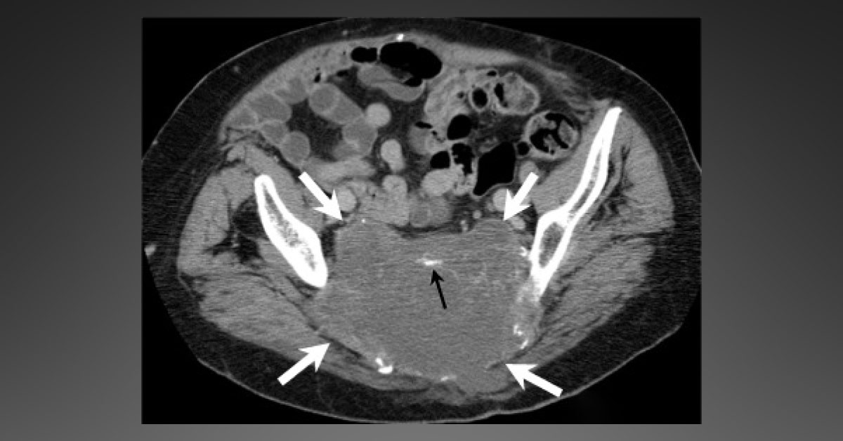 What's Your Diagnosis for This Patient?