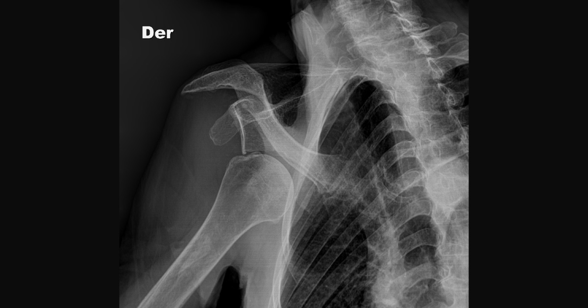 Spot The Diagnosis