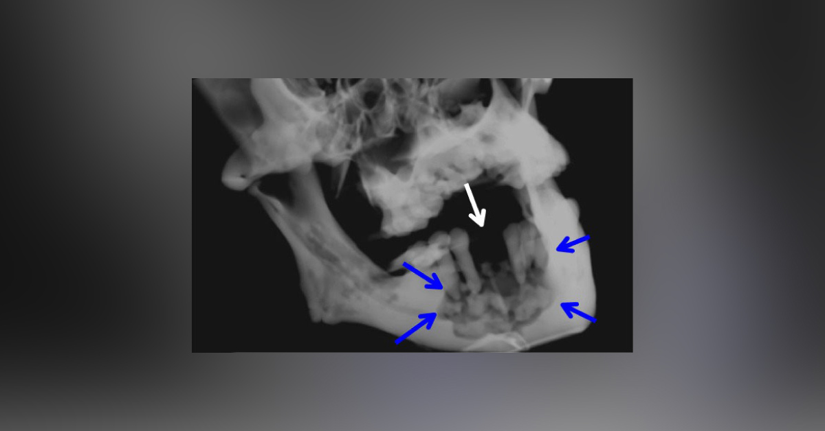 What Interpretation Can You Make From This CT Of The Mandible?