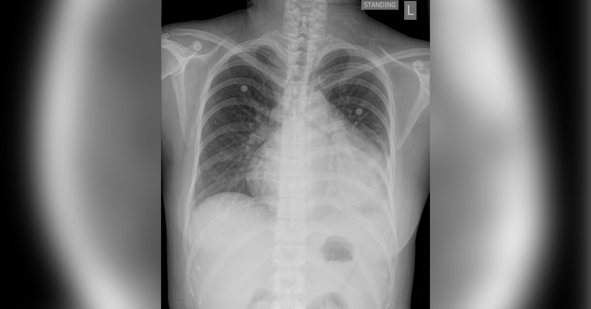 What Does This X-Ray Reveal?