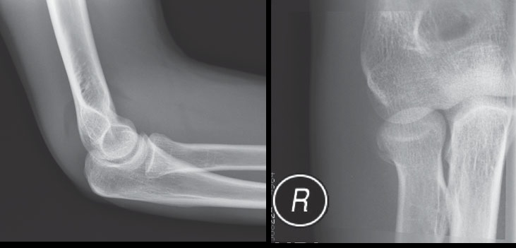 Interpret This Radiological Image