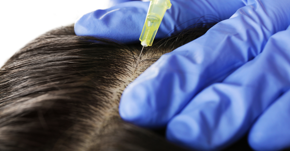 Hair Transplant Specialist Suspended For Two Years 