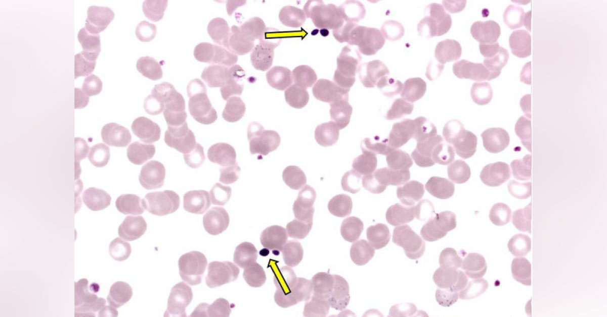 Spot The Infection