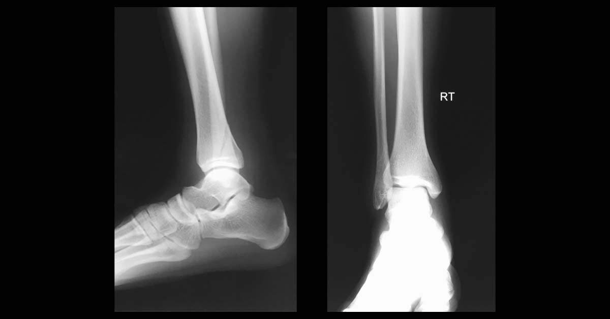Spot The Diagnosis