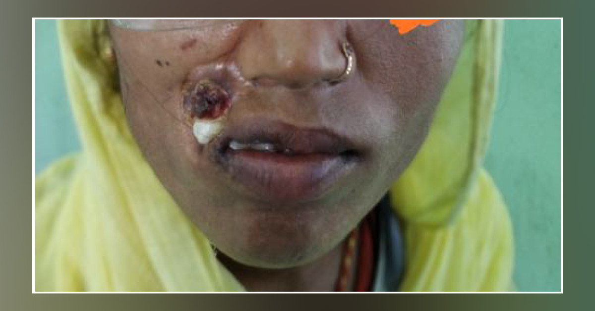 What Is The Provisional Diagnosis?