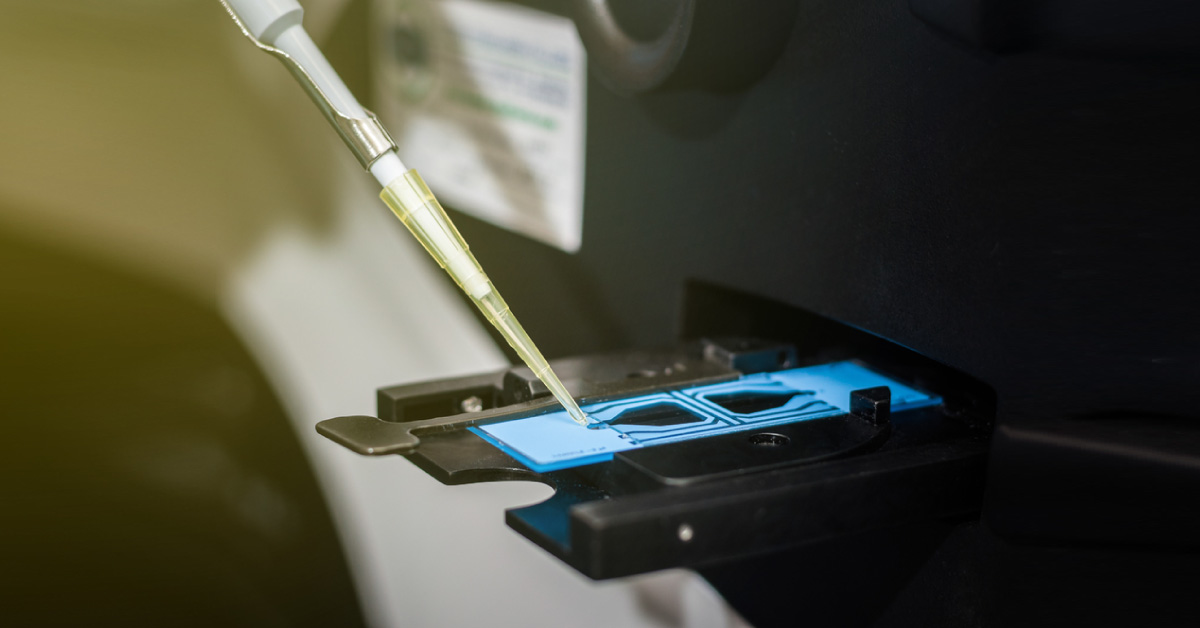 Semen Analysis - Interpretation Made Easy