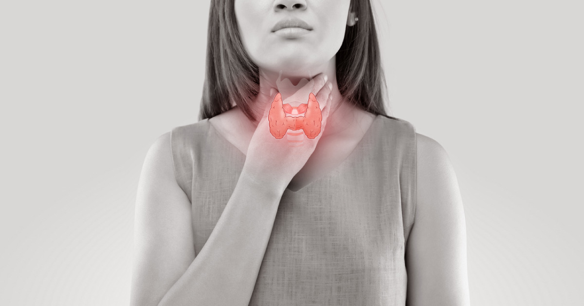 Thyroid  Storm