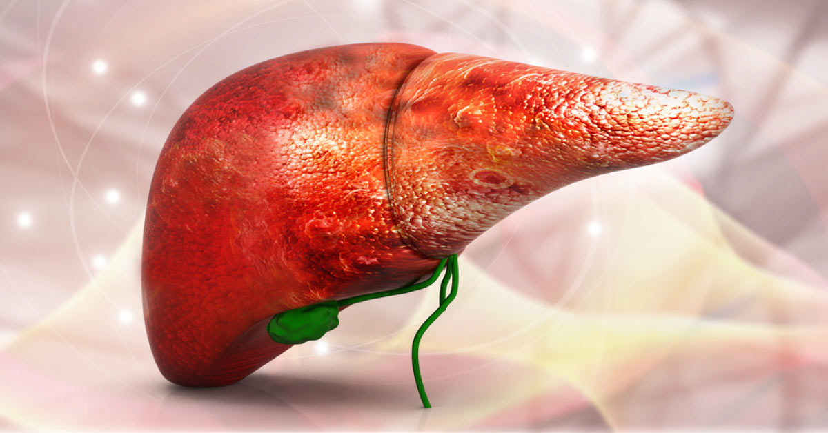 Reciprocal Association Between NAFLD And Drug-Induced Liver Injury