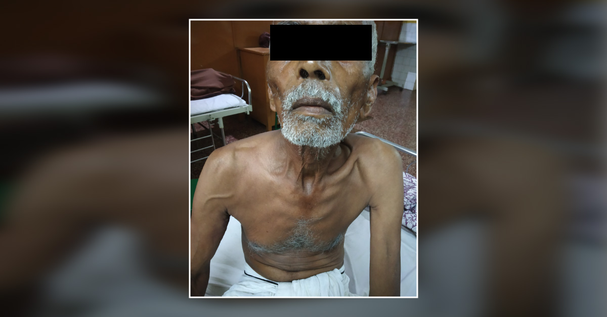 Case Of Developed Chest Pain