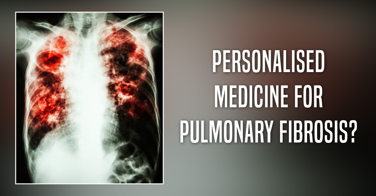 Personalised Medicine for Idiopathic Pulmonary Fibrosis