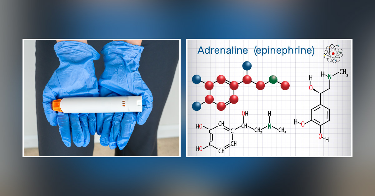 Should Epinephrine Be Combined With Local Anesthesia For All Cases?