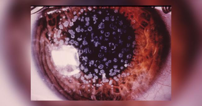 Brief Review On Congenital Abnormalities