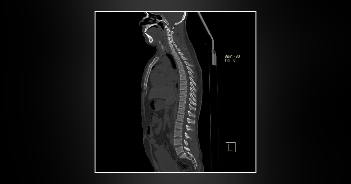 Diagnose This Case